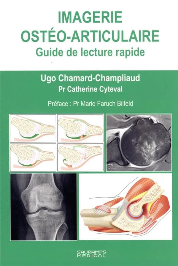 Imagerie ostéo-articulaire : guide de lecture rapide