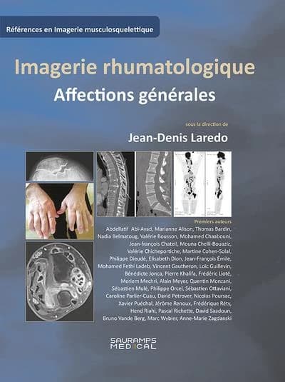 Imagerie rhumatologique : affections générales